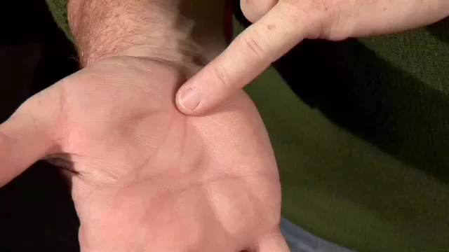 Thumb 5